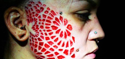 Scarificazione Peeling