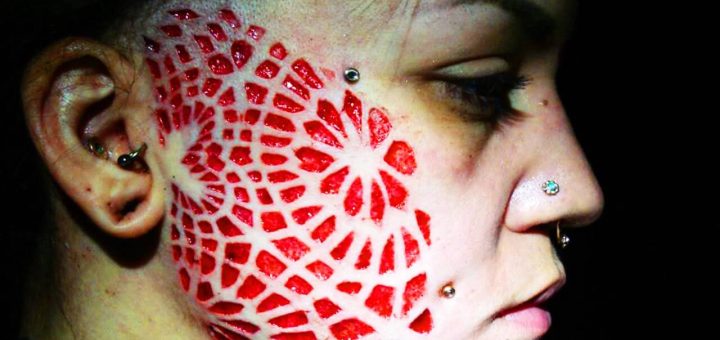 Scarificazione Peeling